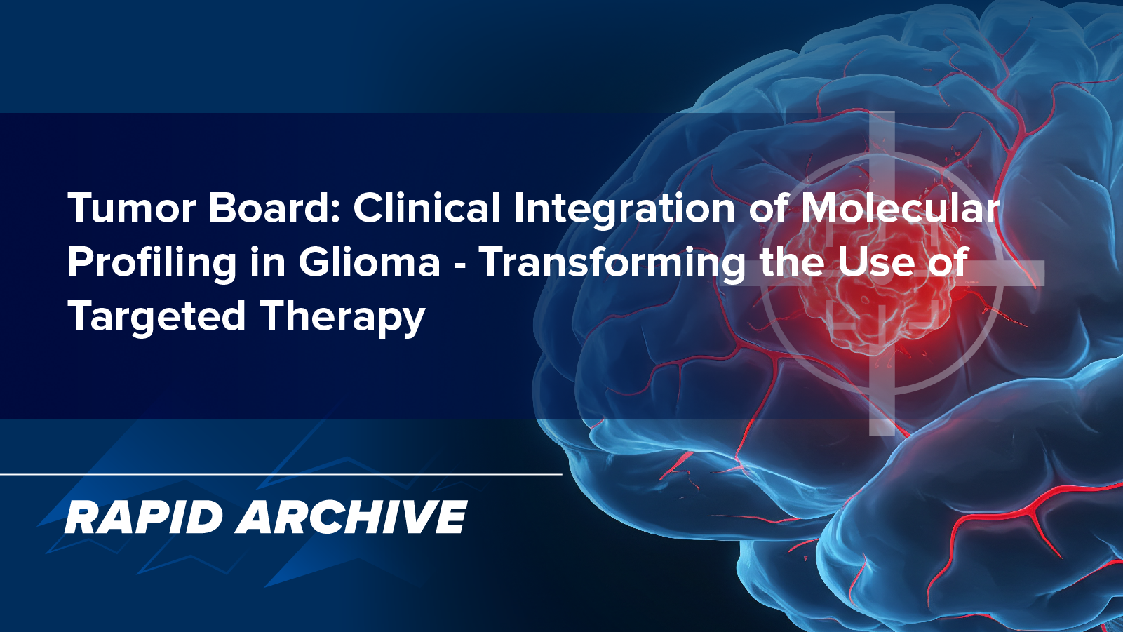 Tumor Board: Clinical Integration of Molecular Profiling in Glioma—Transforming the Use of Targeted Therapy