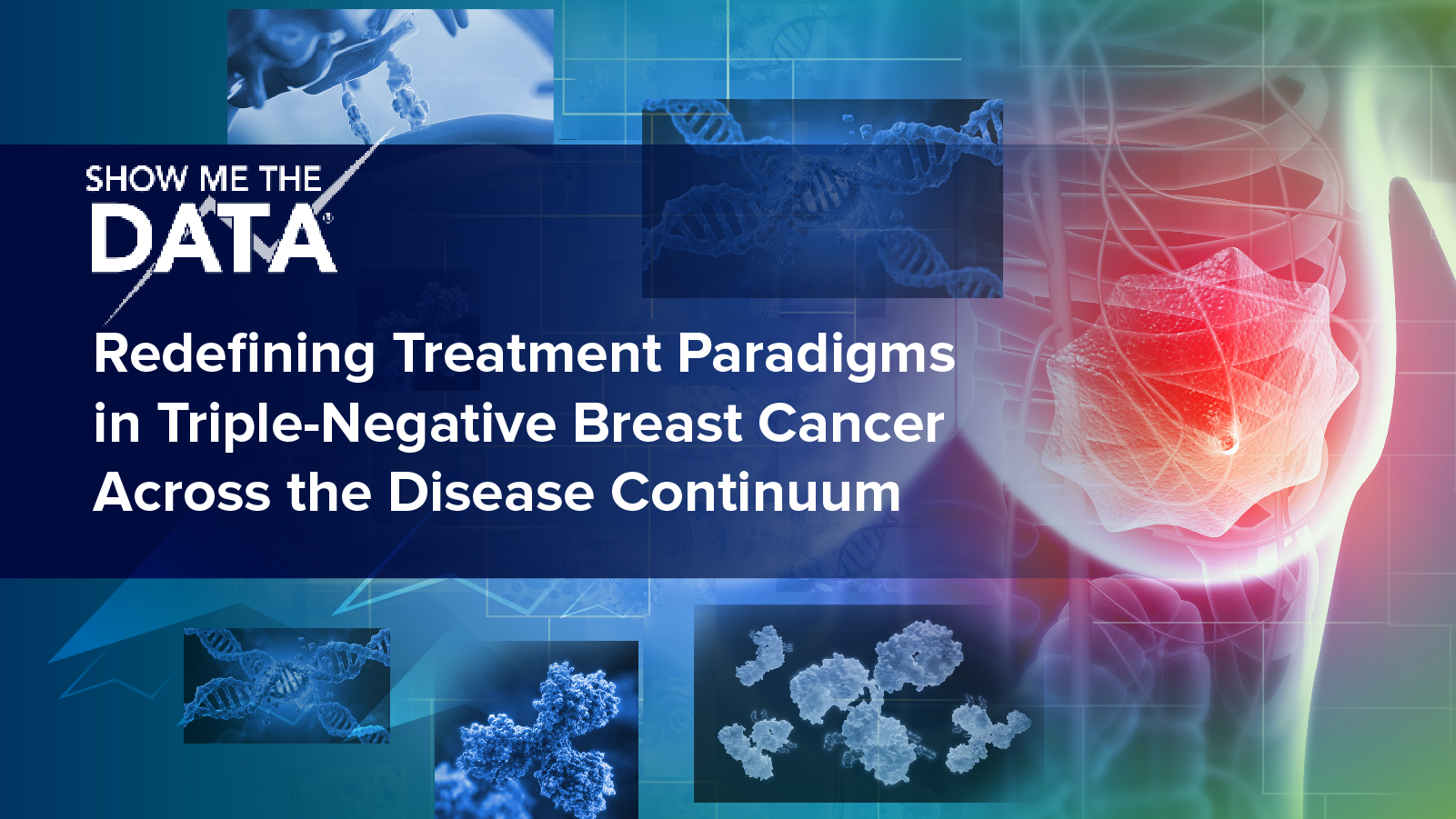 Show Me the Data™: Redefining Treatment Paradigms in Triple-Negative Breast Cancer Across the Disease Continuum