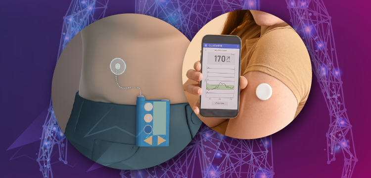 From Numbers to Navigation: Translating Data From Diabetes Technologies into Optimized Decision-Making