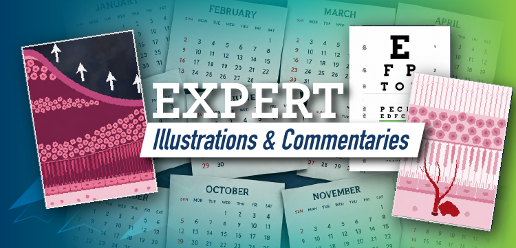 Expert Illustrations & Commentaries™: The Science of Extended Durability