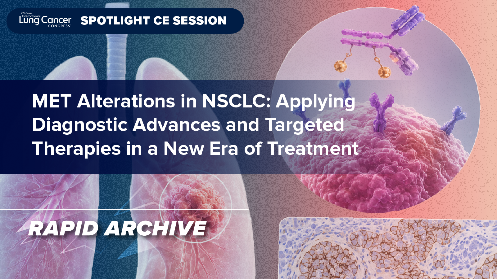 𝘔𝘌𝘛 Alterations in NSCLC: Applying Diagnostic Advances and Targeted Therapies in a New Era of Treatment