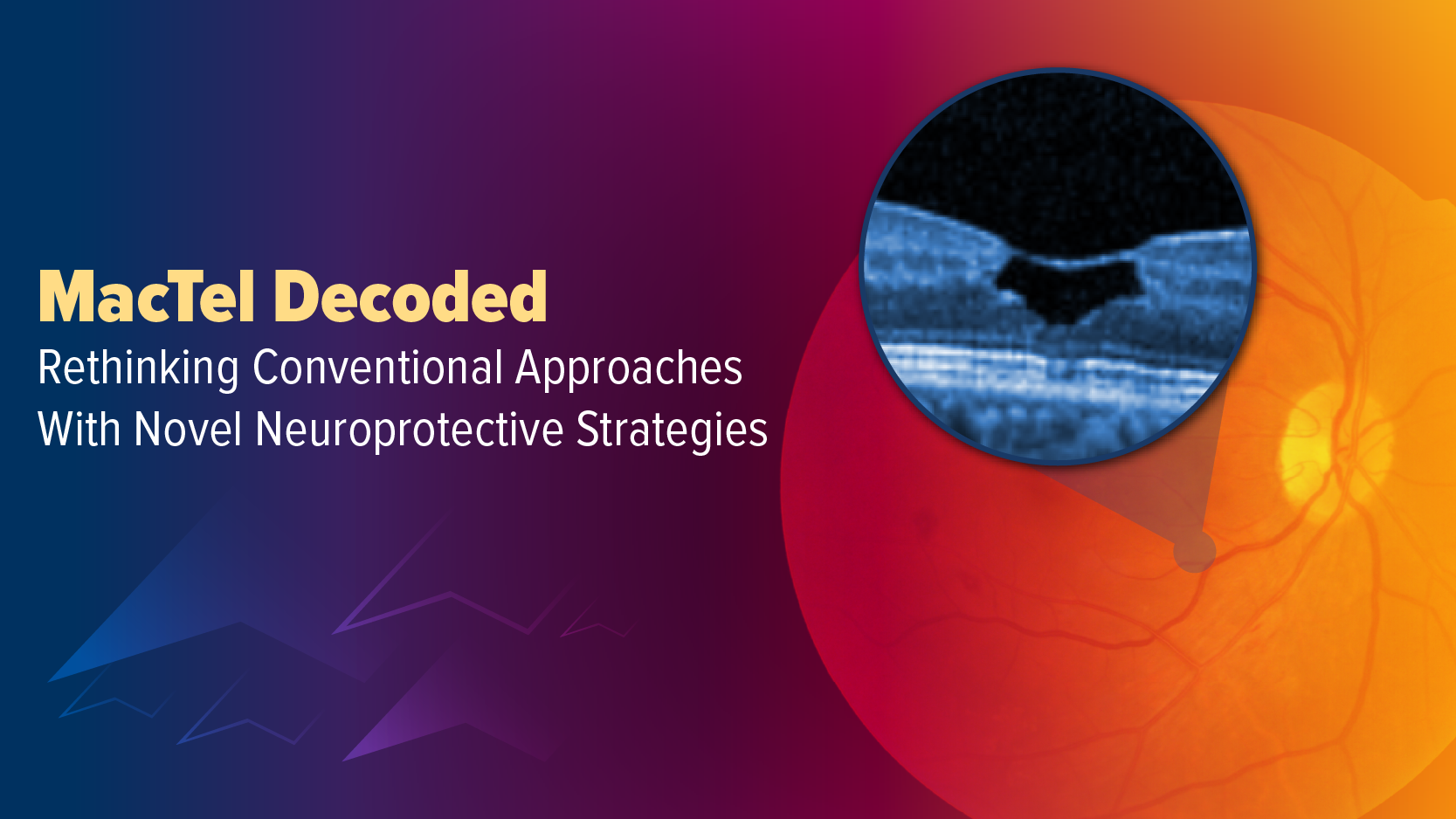 MacTel Decoded: Rethinking Conventional Approaches With Novel Neuroprotective Strategies