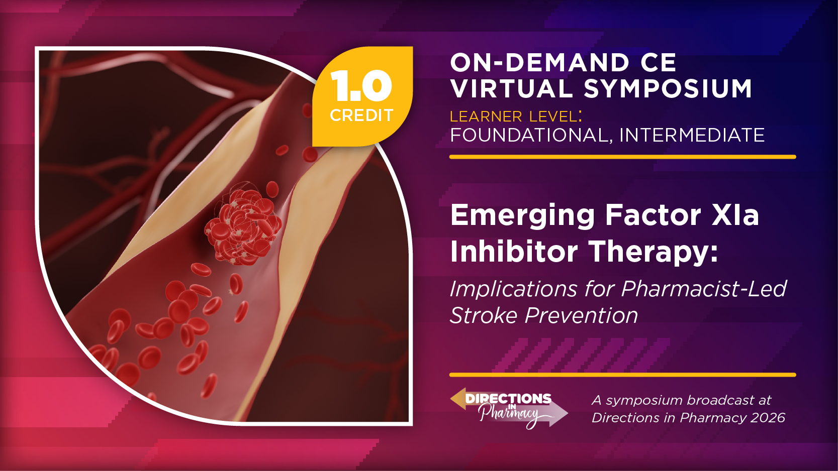 Emerging Factor XIa Inhibitor Therapy: Implications for Pharmacist-Led Stroke Prevention