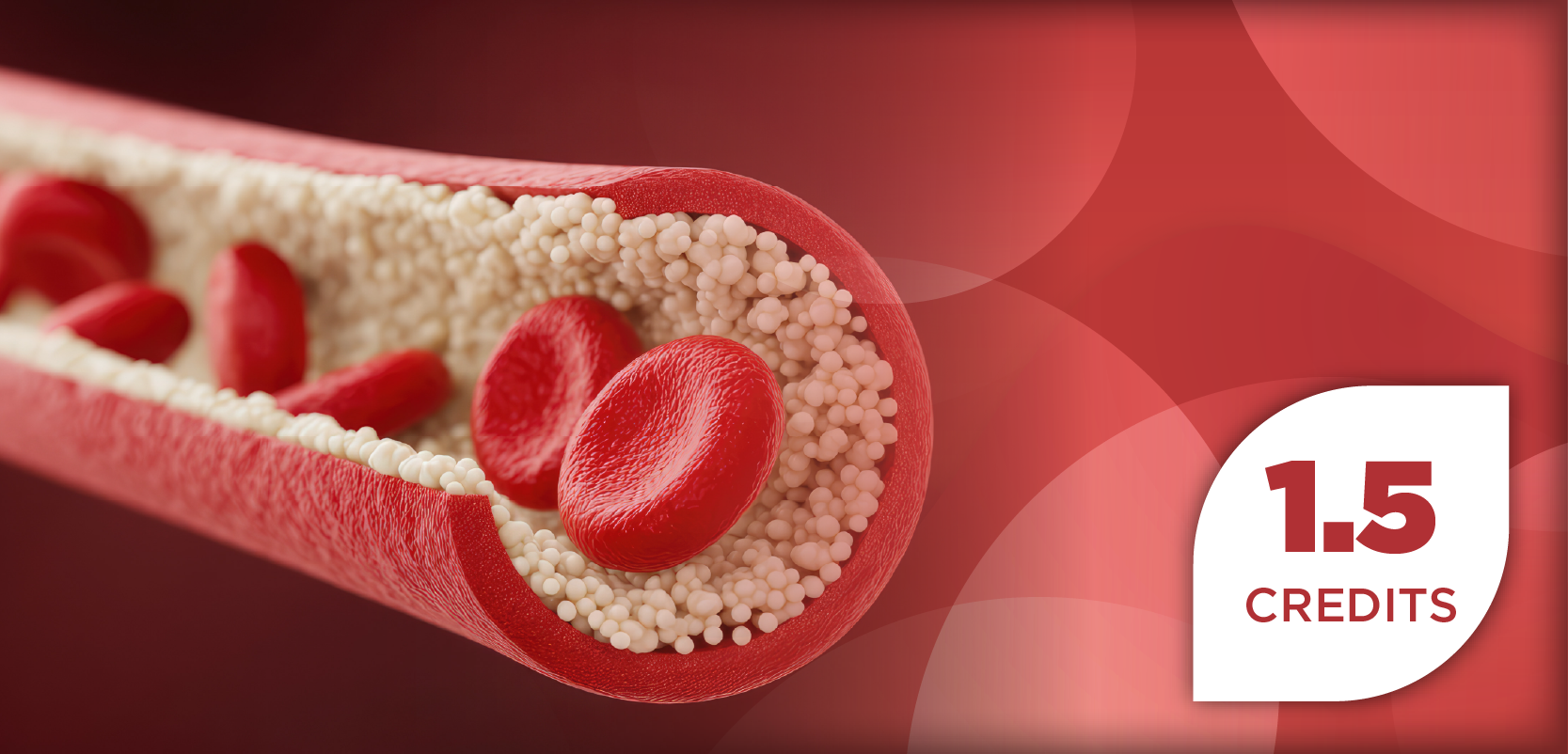 Mastering Hyperlipidemia Management: Enhancing Adherence and Expanding Nonstatin Therapy Options