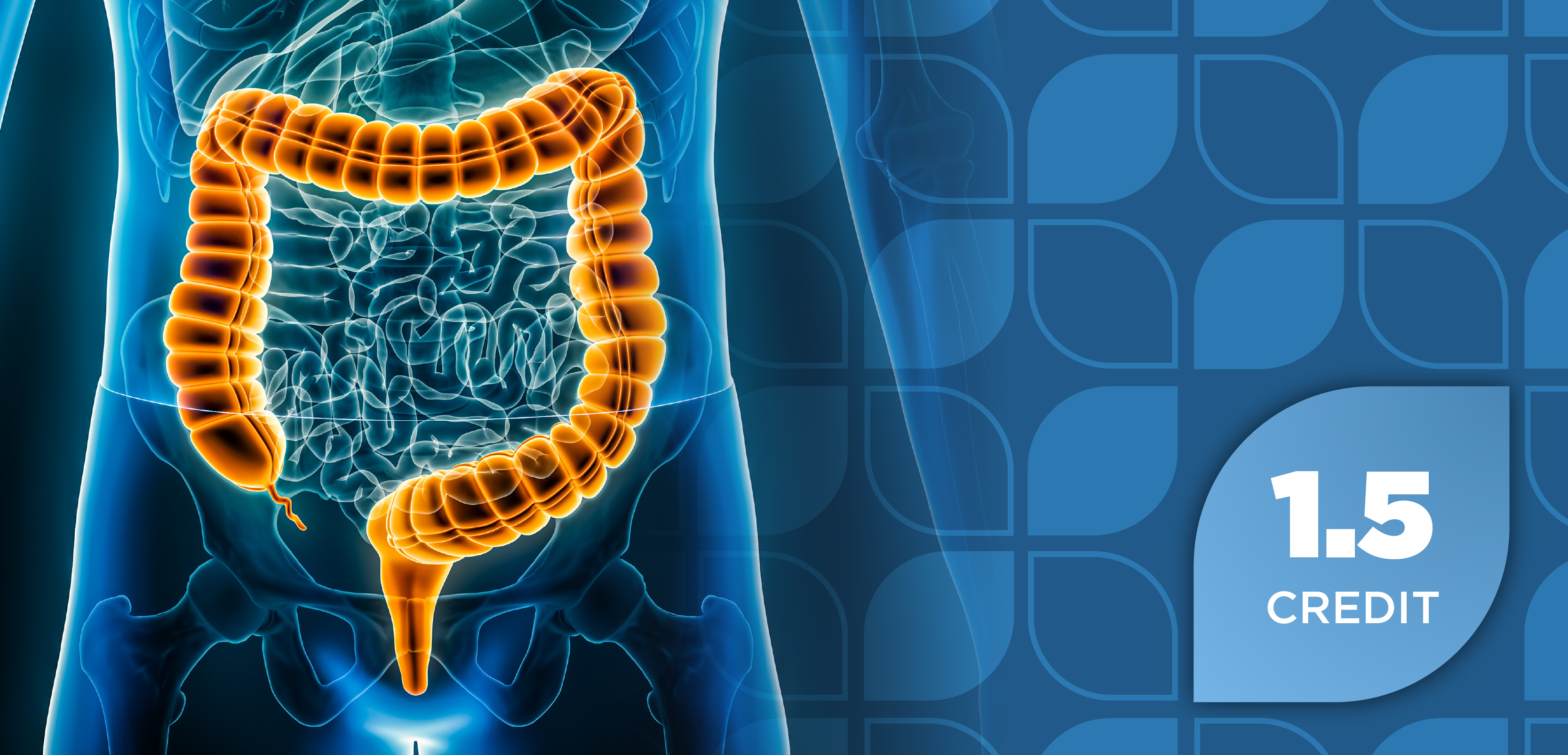 Innovations in Inflammatory Bowel Disease Therapy: How IL-23 Inhibitors Are Shaping Treatment and Managed Care Approaches