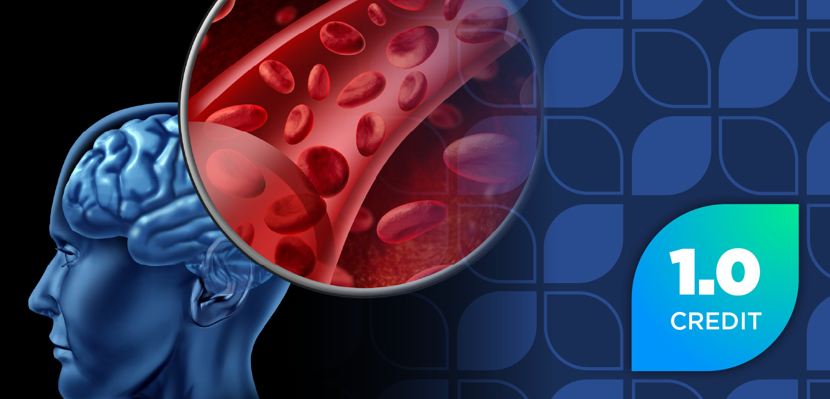 Understanding the Pearls and Pitfalls of Nimodipine in Aneurysmal Subarachnoid Hemorrhage: Opportunities to Improve Patient Outcomes