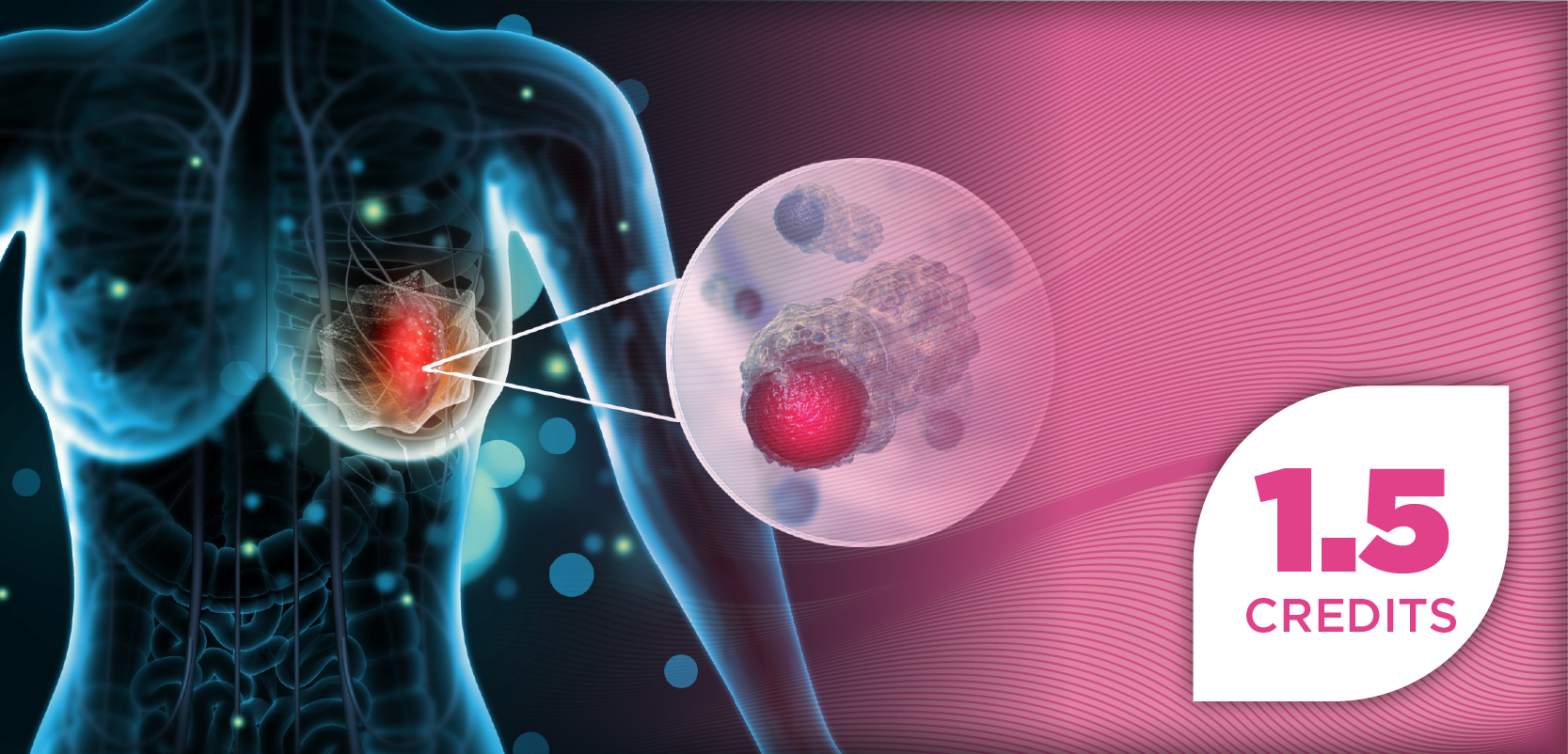 Optimizing HER2-Directed Therapy in Metastatic Breast Cancer: From HER2-Positive to HER2-Ultralow