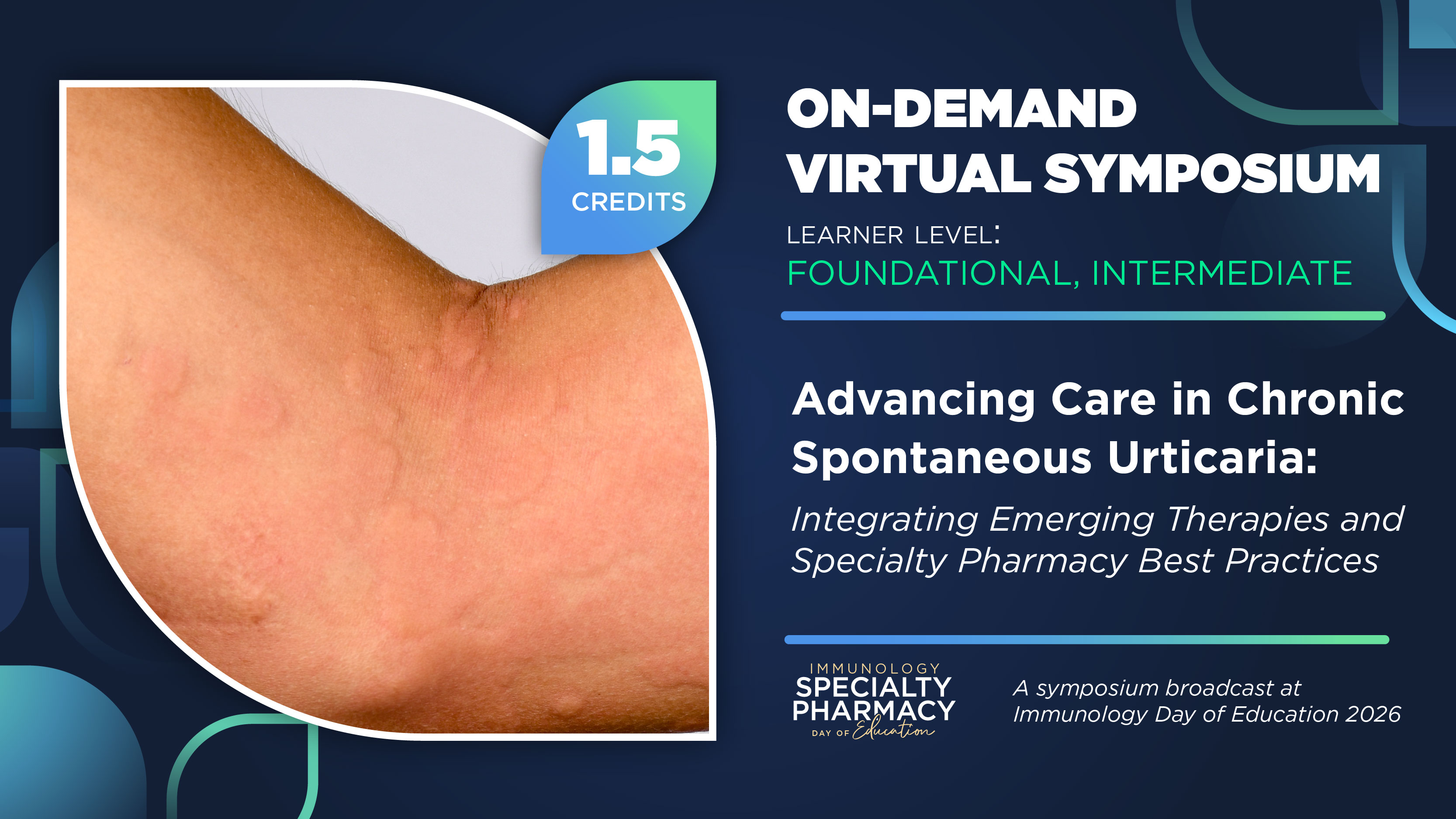 Advancing Care in Chronic Spontaneous Urticaria: Integrating Emerging Therapies and Specialty Pharmacy Best Practices