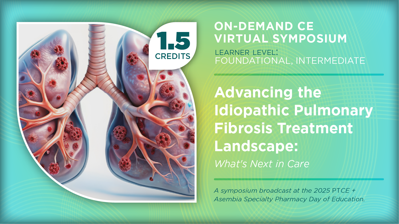 Advancing the Idiopathic Pulmonary Fibrosis Treatment Landscape: What’s Next in Care