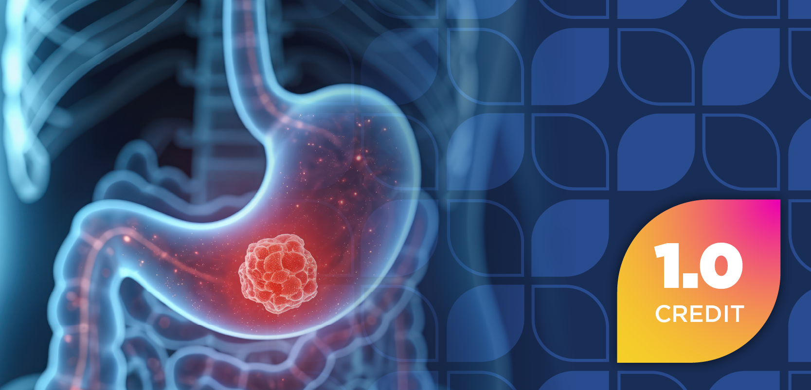Pharmacists at the Forefront: Enhancing Targeted Therapy Implementation and Patient Outcomes in Advanced Gastric Cancer