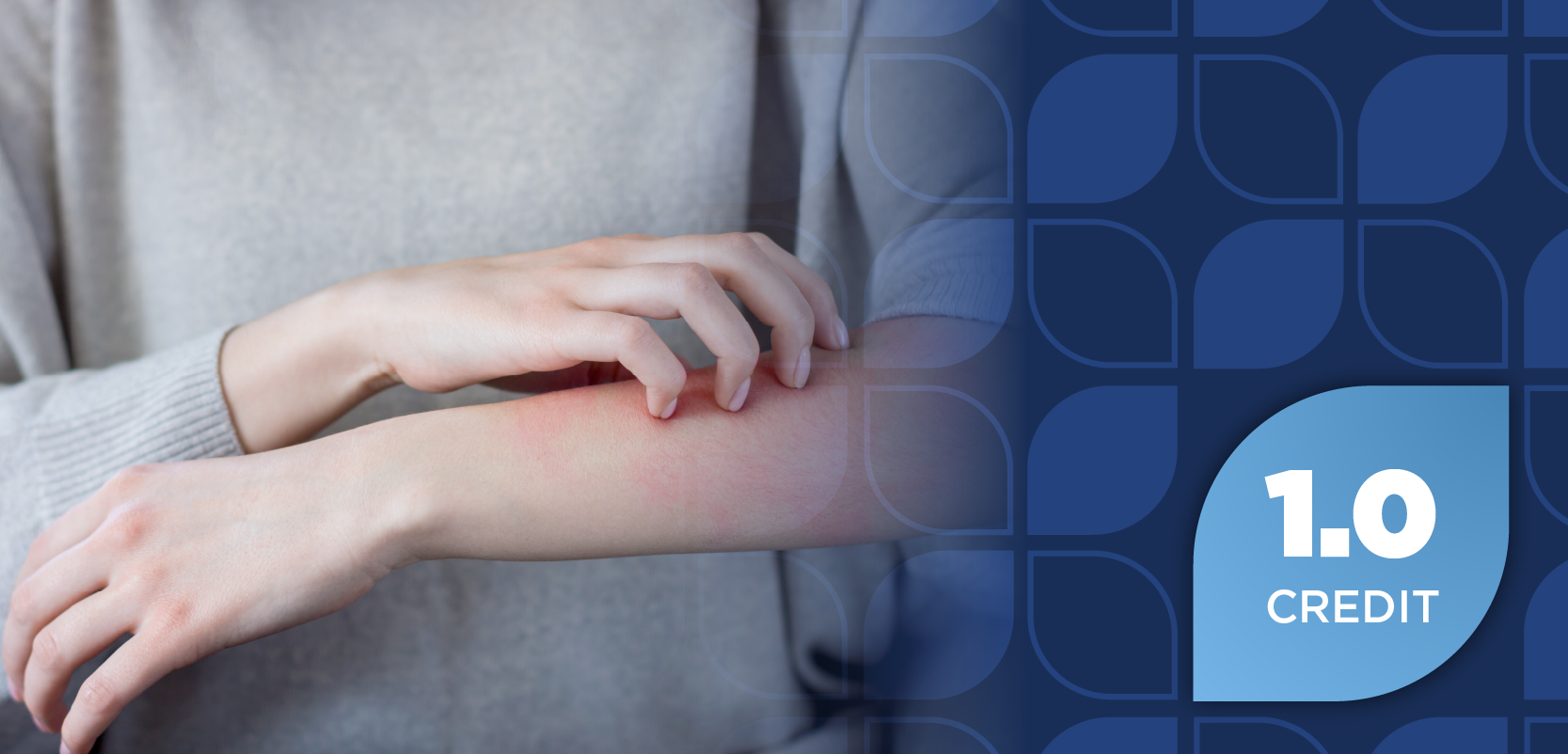 Access and Formulary Design Considerations for Nonsteroidal Topical Therapies in Dermatology