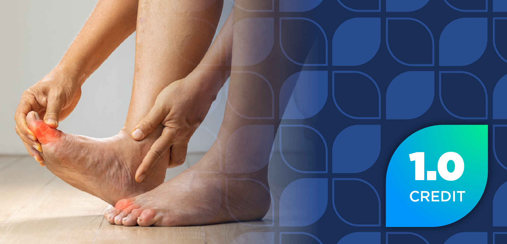 Transforming Gout Care: Navigating Barriers and Therapeutic Advances in Disease Management