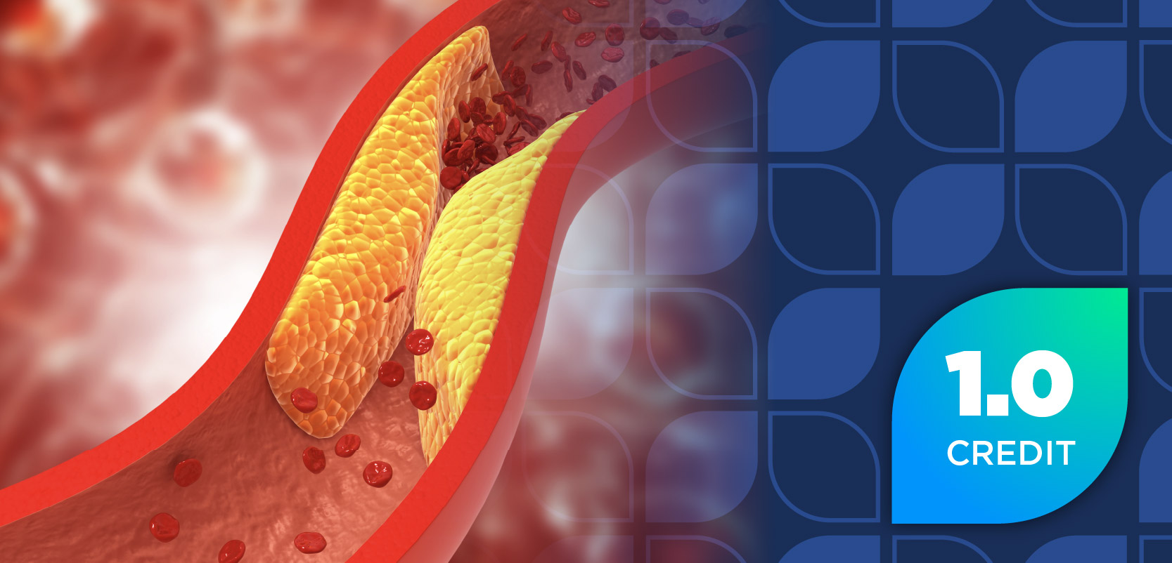 Improving Outcomes in Lipid Management: Aligning Managed Care Policy With Emerging Guideline Updates and Non-Statin Therapeutic Advances