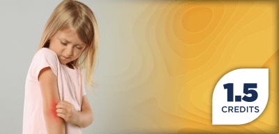 Type 2 Inflammation in Focus: Advancing Pediatric Atopic Dermatitis Care With Biologic Therapies
