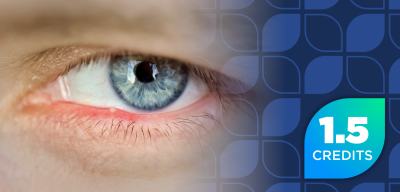 Evolving Care: Treating Demodex Blepharitis for Pharmacists (Pharmacy Technician Credit)