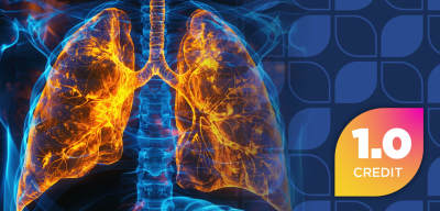 The Right Regimen, the Right Workflow: Immunotherapy Insights for Advanced Non-Small Cell Lung Cancer in the Absence of Targetable Mutations