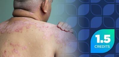 The Expanding Psoriasis Treatment Landscape: Leveraging the Pharmacist's Role in Patient Care to Improve Access and Outcomes for TYK Inhibitors