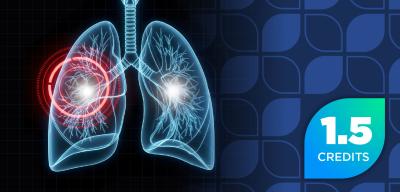Evolving Therapeutic Targets in Small Cell Lung Cancer: Updates and Insights for Managed Care