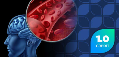 Understanding the Pearls and Pitfalls of Nimodipine in Aneurysmal Subarachnoid Hemorrhage: Opportunities to Improve Patient Outcomes