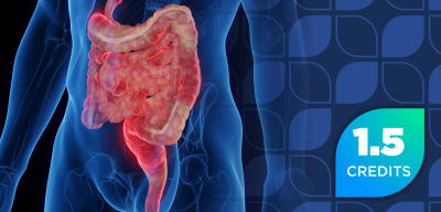 Preparing to Integrate TL1A Inhibitors Into Evidence-Based Care for Inflammatory Bowel Disease