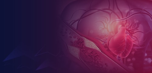Optimizing Lipid-Lowering Strategies for ASCVD Risk Reduction: Bridging the Gap in Treatment Intensification