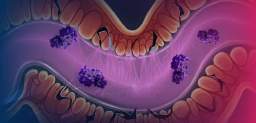 Is TNF-Like Ligand 1A (TL1A) Inhibition the Answer to Improving Disease Remission in Inflammatory Bowel Disease?