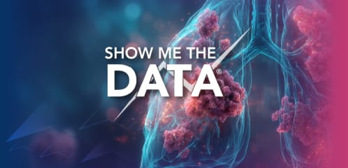 Show Me the Data™: Redefining Extensive-Stage SCLC — Emerging Therapies, CNS Considerations, and the Radiation Oncologist's Evolving Role