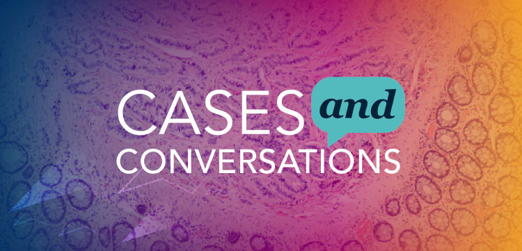 Cases and Conversations: Redefining EP-NEC Diagnosis and Management—Integrating DLL3 Into Pathology Practice